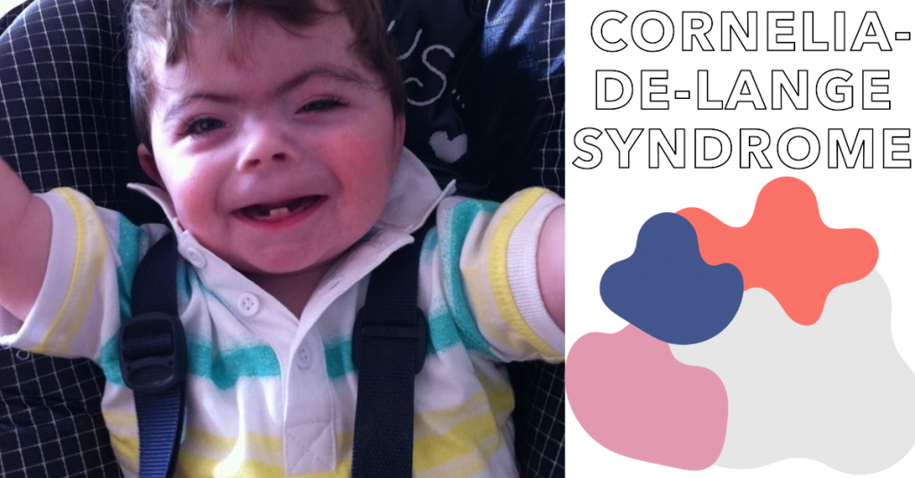 Cornelia De Lange Syndrome